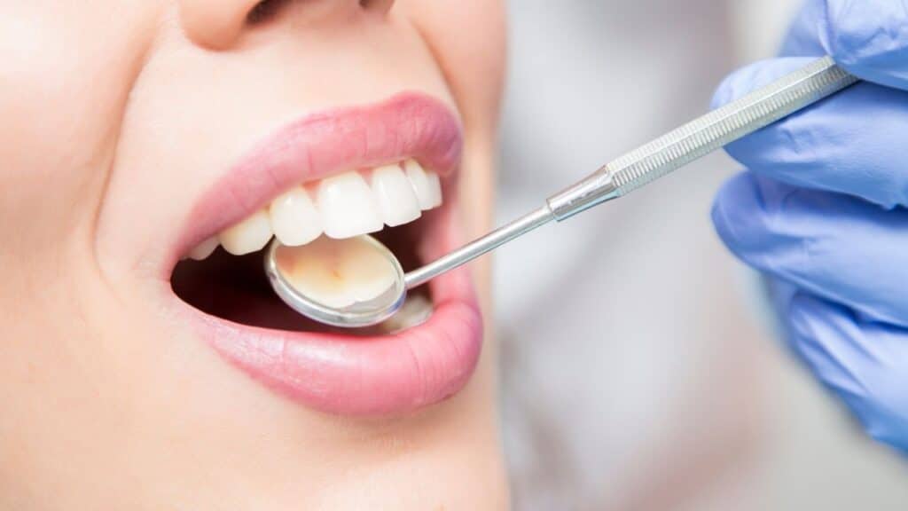 fillings in brighton